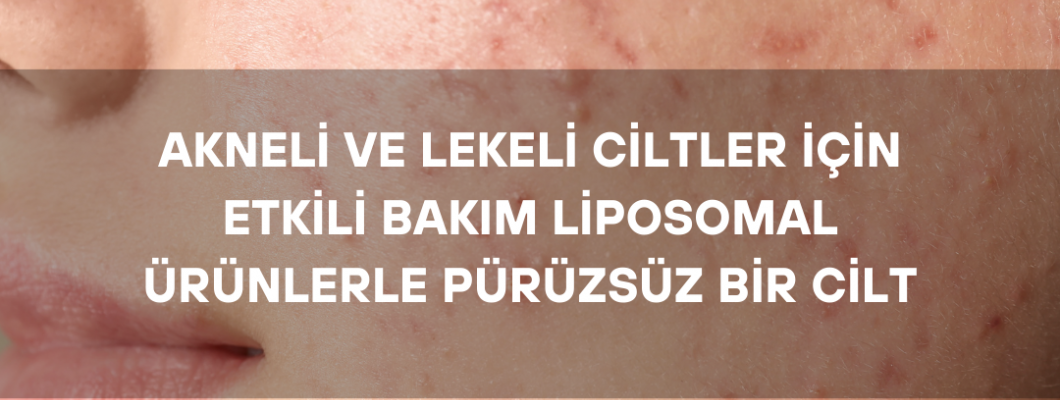 Akneli ve Lekeli Ciltler İçin Etkili Bakım: Liposomal Ürünlerle Pürüzsüz Bir Cilt