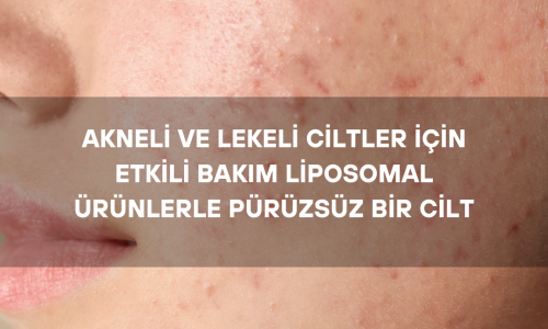 Akneli ve Lekeli Ciltler İçin Etkili Bakım: Liposomal Ürünlerle Pürüzsüz Bir Cilt