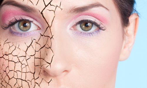 Ciltteki Kuruluk İçin En İyi Nemlendirici Ürünler